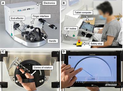 Reliable and Valid Robotic Assessments of Hand Active and Passive Position Sense in Children With Unilateral Cerebral Palsy